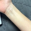 솔지 | 임산부 압박스타킹 의료용 처방받은 이유, 가격, 착용 솔지 후기는?
