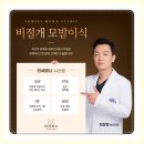1237 | 49세 남자 엠자탈모 비절개모발이식 1237모낭 7개월차 수술후기 by 강남역 비절개모발이식전문 연세모나...