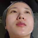 (주)바를참스킨 | 무안군 남악피부관리추천샵 카라쩡의 피부 재탄생 스피큘 필링 후기