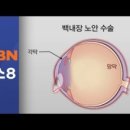 베네치아안경 이미지