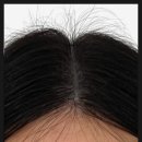 로건스칼프&다이어트센터