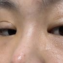 아침햇살약국 | 일양약품 닥터프리메틱 크림, 약국템으로 기미 미백 2주 만에 끝낸 리얼 후기