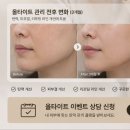 양주 슈링크 비용 싼곳 샤인유의원으로 피부 탄력 되찾기