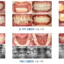 라임나무치과병원 네이버블로그