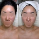 동문외과 | 내돈내산 경락샵 5탄: 성형외과 리프팅 원리와 같은 안면유지인대 관리 솔직후기