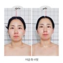 V-1 | 군산 미장동 윤곽관리에 진심 에스뷰티 더윤곽 V핏 관리 후기