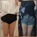 멍캣 | 압구정 로데오역 피부과 허벅지지방분해주사 바디캣 4회차 변화 후기