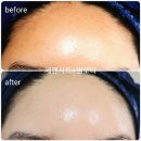 라비에 에스테틱 이미지