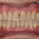 서울오브치과병원 이미지