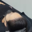 디에스가발 | 수원 디에스엠피에서 두피관리로 콤플렉스 극복한 후기