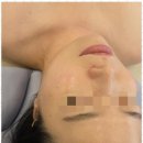 (주)스킨아이 네이버블로그