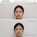 르수플