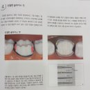 캐드캠치과기공소 | 치과 임상 서적 정리 - 달인이 될 수 있는 디지털 시대의 치관수복
