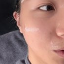 화이트필의원 | 대구 삼덕동 피부관리 여드름 '솔에스테틱' 가격 및 관리 후기