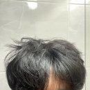 지성팜 | [ 더마프 샴푸 ] 지성 비듬 약산성 탈모증상완화샴푸 추천드립니다~!
