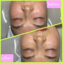 수원-2037 | 수원 피부관리 숨결클렌징 전문 '보엘르에스테틱'