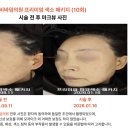 우소세강한의원 | 경기양주피부과 기미제거 10회 패키지가 정답?