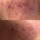 주식회사 한국풀빅산 | [공지] [급구] 풀빅산 설렘 비누 체험단 모집합니다 ! (종료)