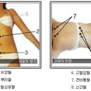 사혈 - 모든 부인병에 활용되는 사혈 혈 이미지