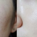 아유메디 이미지