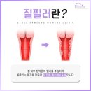 삼성필의원 | 질필러 부작용, 탄력 찾으려다 오히려 염증 생겼다? 윙크필 후기 주의사항