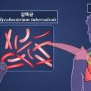 폐결핵에 좋은음식 이미지