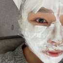 호인메디칼 | 재생 스킨부스터 엑소좀 엑소라인리파인 솔직 후기 경과 기록