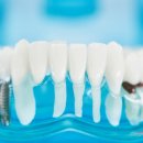 더심플란트치과의원 이미지