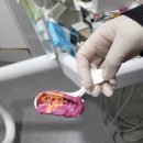 마이덴치과의원 | 한 달 전 연세 마이덴치과 신경치료 완료 후 오늘...본(인상체득) 뜨고 담주로 예약 잡고 왔어요(치료후기)