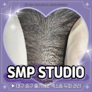 리젠셀의원 | 대구 두피 케어 줄기세포 엑소좀 관리 SMP스튜디오