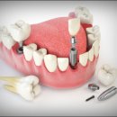 뿌리심는치과의원 이미지