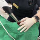 수연치과의원 | [공릉온치과] 원장님 임플란트 보철물 본 뜨는 날