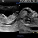 인천제일산부인과의원 이미지