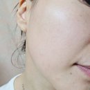 리페어네트워크 | 재생크림 추천 피부과에서 쓰는 블리비 엑소 리페어 크림 솔직 후기