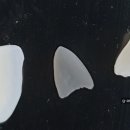 지안치과기공소 이미지