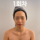 에스테티아(고양원흥역점) | 에스테티아 고양 원흥역점 윤곽관리 30회 후기 | 내돈내산 윤곽관리