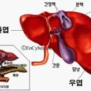 간이 안 좋을 때 나타나는 증상 20가지 이미지