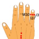 고려수지침 복현지회 이미지