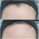 순수정원에스테틱