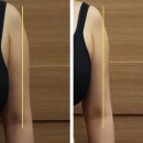 (주)다울푸른도장 | 팔 무한람스 2,3주차 | 멍 붓기 과정 변화없음 솔직후기 중저주파 치료 실천지수 적립방법