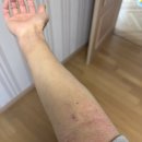 바른샘 | 바른샘한의원 후기 마지막