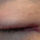 컴포트성형외과의원 이미지