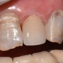 바라던 치과기공소 이미지