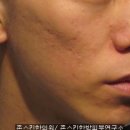 존스킨한의원 이미지