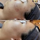 반스스킨케어