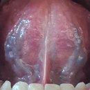 췌장암/혀//8맥교회혈/금진옥액/와사증/기적의 민간요법/중풍 이미지