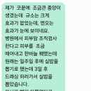 피부암 조직검사후. 종기제거 등 이미지