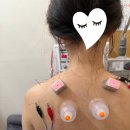 자향한방병원 | 교통사고 자향 한방병원 입원 2일차~퇴원 후기