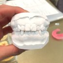 연세진석치과교정과치과의원 | 김포교정치과 추천 구래동 연세진석치과, 내돈내산 교정 후기와 유지관리까지