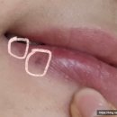 강남피어리의원 이미지